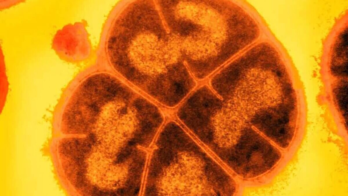    Deinococcus radiodurans© Michael J. Daly/USU