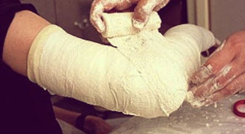 Практически весь август я провела в таком гипсе