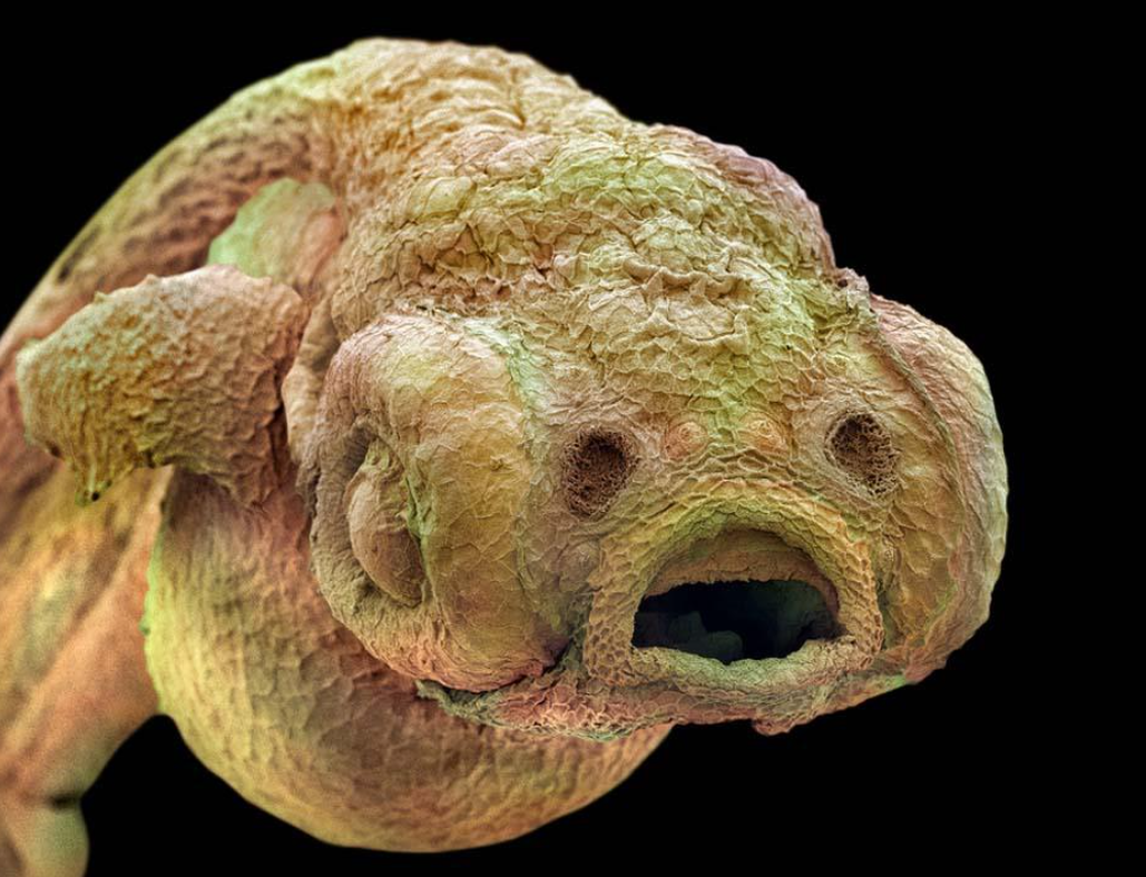 Самые тяжелые организмы. Микрофотография дождевого червя. Чудовища под микроскопом. Страшные микробы под микроскопом.