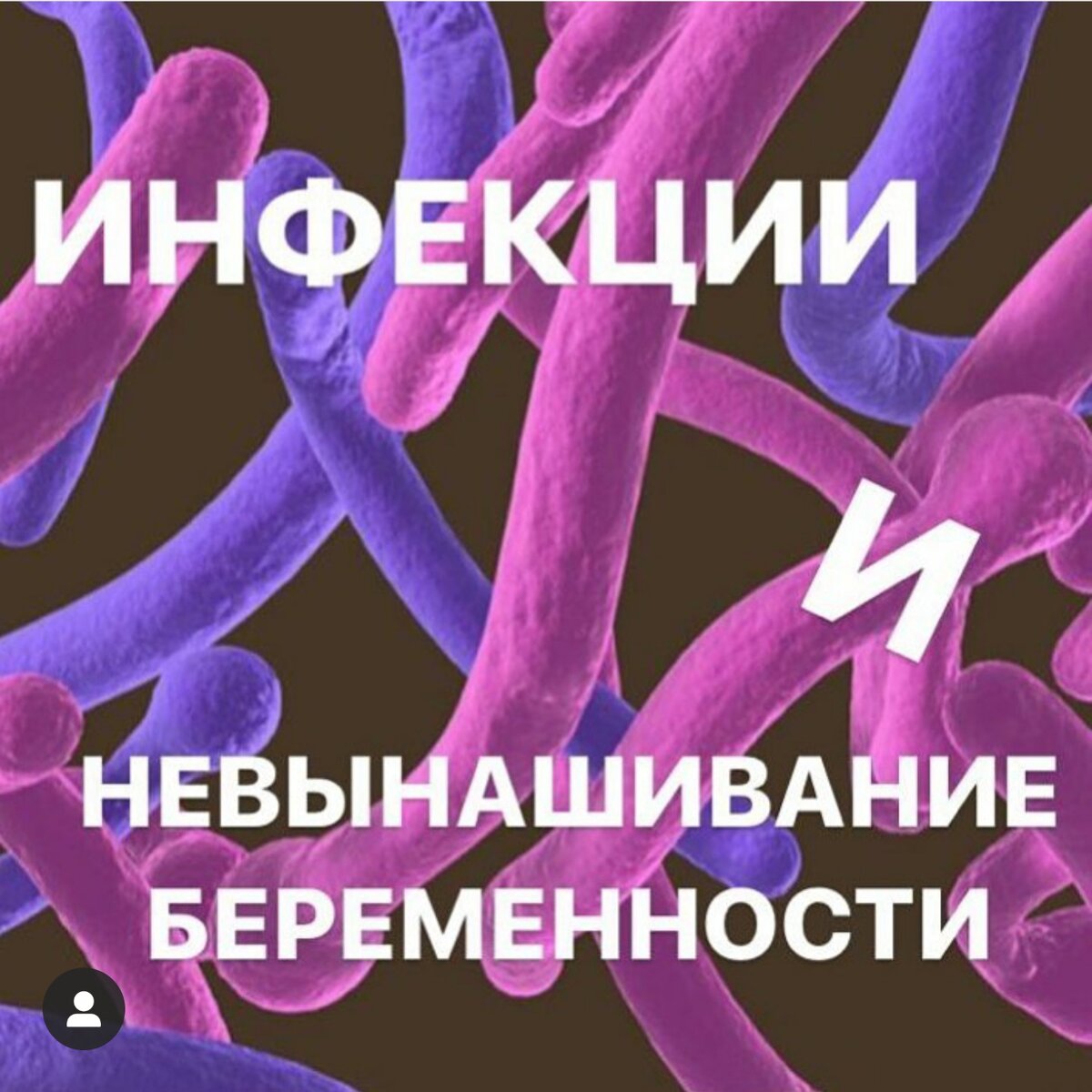 А знаете ли вы, что вагинальные инфекции могут привести к невынашиванию беременности❔
⠀
Да, это действительно так‼️
⠀
В частных медицинских центрах очень любят на этом зарабатывать.
⠀
Сейчас, я Вам расскажу, как вы сможете сэкономить ваши денежки. Я вам расскажу, как лечить самые распространенные заболевания.
⠀
Поехали... 🚀
⠀
Урогенитальный трихоманиаз☑️
⠀
Метронидозол 500 мг 2 раза в сутки в течение 7 дней или метронидазол 2,0 г однократно (не ранее 2 триместра в сочетании с местной терапией).
⠀
Гонорея☑️
⠀
Цефтриаксон 500 мг в/м однократно или цефиксим 400 мг перорально однократно на любом сроке беременности в условиях стационара.
⠀
Mycoplasma genitalium☑️
⠀
Джозамицин 500 мг 3 раза в сутки в течение 10 дней на любом сроке беременности.
⠀
Хламидийная инфекция☑️
⠀
Джозамицин 500 мг перорально 3 раза в сутки 7 дней или азитромицин 1,0 г перорально однократно на любом сроке беременности.
⠀
Урогенитальный кандидоз☑️
⠀
Натамицин (суппозитории вагинально) - с 1 триместра. Клотримазол (таблетки вагинально) - со 2 триместра беременности. 👉🏻
⠀
Бактериальный вагиноз☑️
⠀
1 триместр - местная терапия (антисептик, затем - препараты содержащие молочную, аскорбиновую кислоту). 2 и 3 триместры - метронидазол 500 мг внутрь 2 раза в сутки 7 дней или клиндамицин 300 мг 7 дней 2 раза в сутки 7 дней.
⠀
Теперь, Вы знаете, как вылечить самые распространенные вагинальные инфекции... однако, конечно‼️любая медикаментозная терапия требует назначения исключительно вашим лечащим доктором ☝🏻
⠀
И помните, что антибактериальная терапия наиболее эффективна в сроке до 20 недель беременности.
⠀
Всем удачных родов🤱🏻