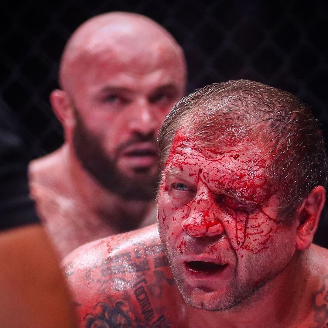 Разбитое лицо Александра после боя.                               источник:https://vk.com/emelianenko_fedor?z=photo-24199118_457284528%2Fwall-24199118_1529171