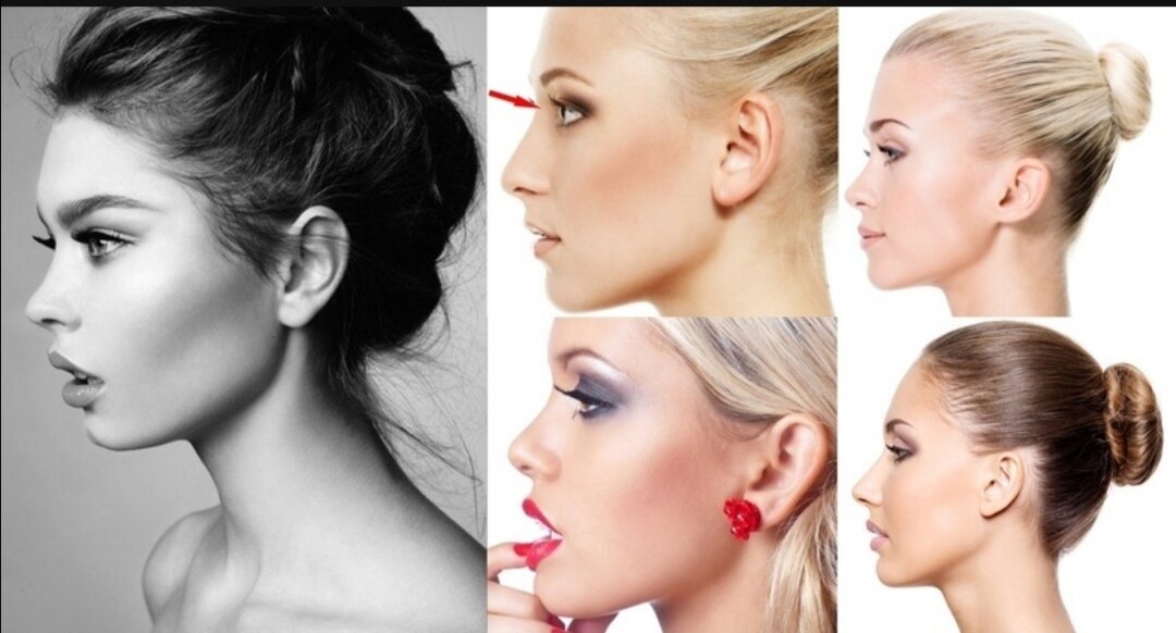 Выпуклые глаза