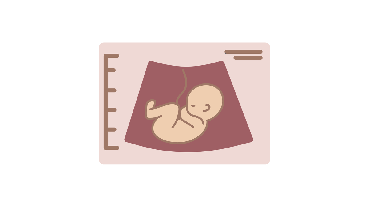 Как определить акушерский срок беременности и дату родов