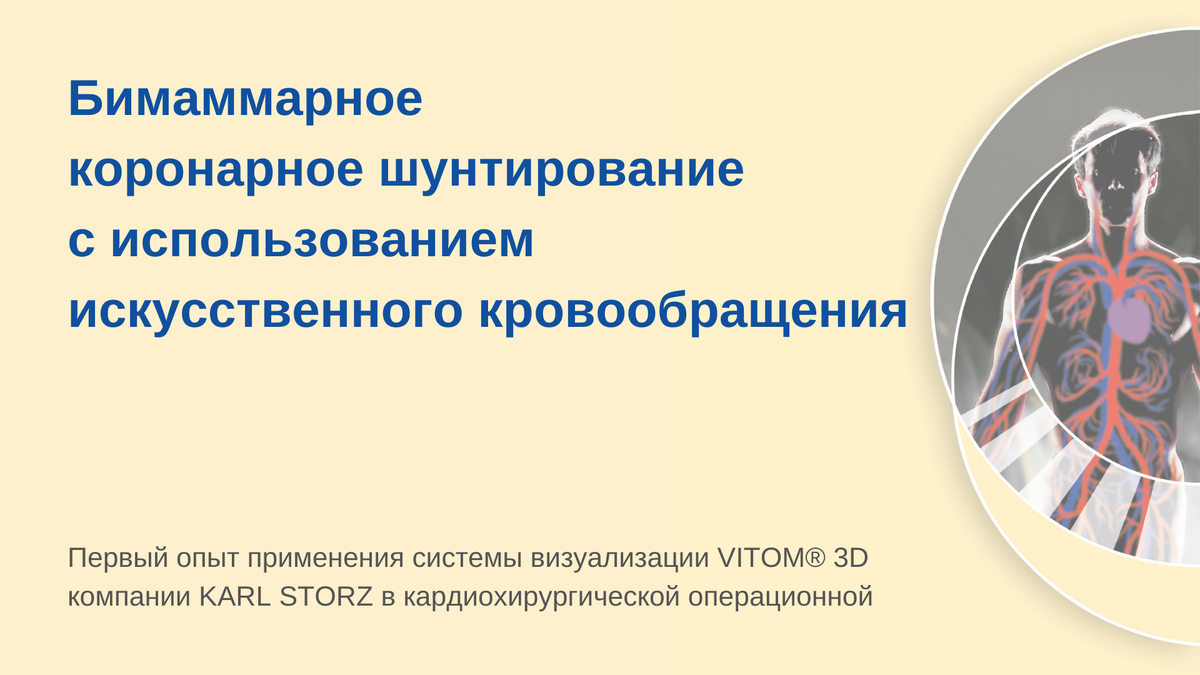 Бимаммарное коронарное шунтирование с использованием искусственного  кровообращения | ENDOGURU | Дзен