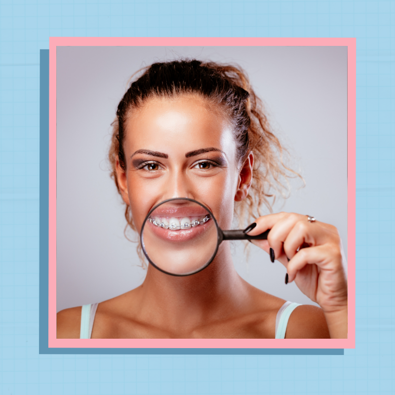 Неправильный прикус