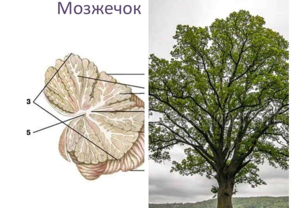 Древо жизни- извилина на поверхности мозжечка