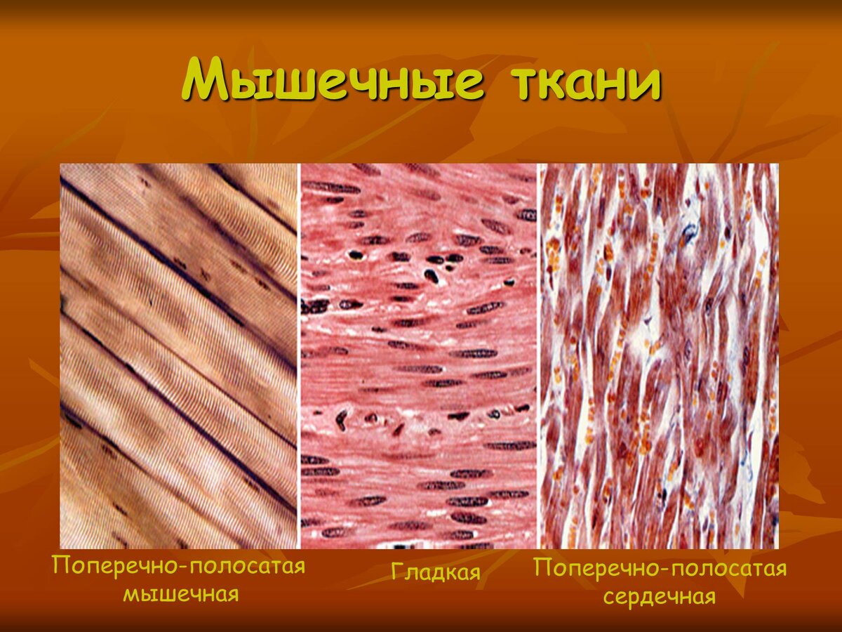 Какая особенность гладкой мышечной ткани. Гладкая соединительная ткань. Поперечнополосатая и гладкая мышечная ткань. Гладкая мышечная ткань микропрепарат. Ткани животных мышечная гладкая микропрепарат.