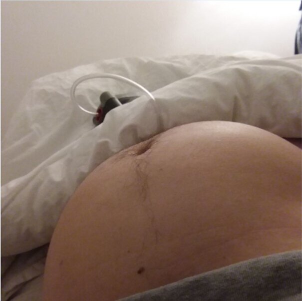 -2