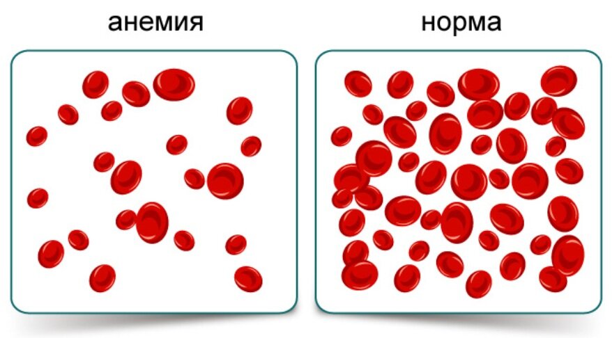 Источник: Яндекс Картинки