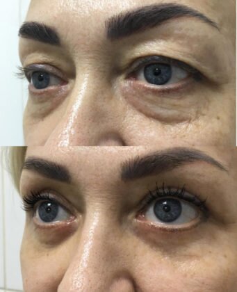 Операция прошла в Solei Clinic