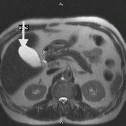 Pin on Hepatobiliary Radiology