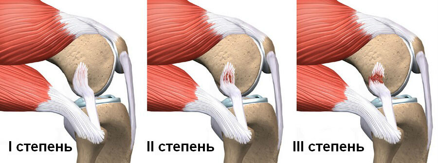 Источник фото  – https://clck.ru/SqwAr