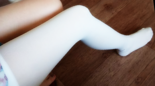 Несколько лет назад  на компрессионных чулках во время родов не настаивали