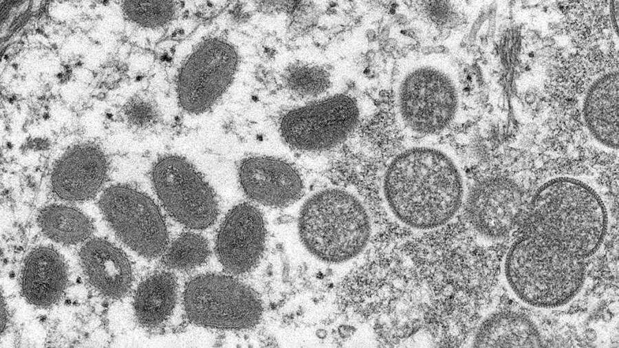 Фото: REUTERS/CDC/Cynthia S. Goldsmith, Russell Regnery