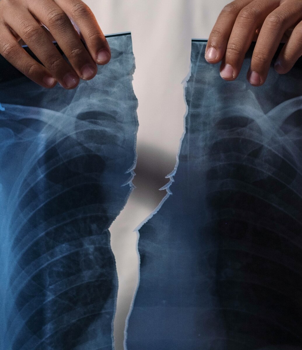 Вирус может нанести серьезный урон органам дыхания