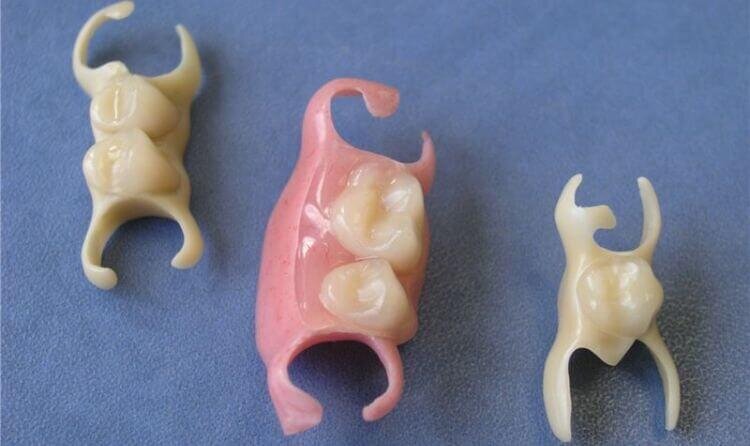 Временные протезы