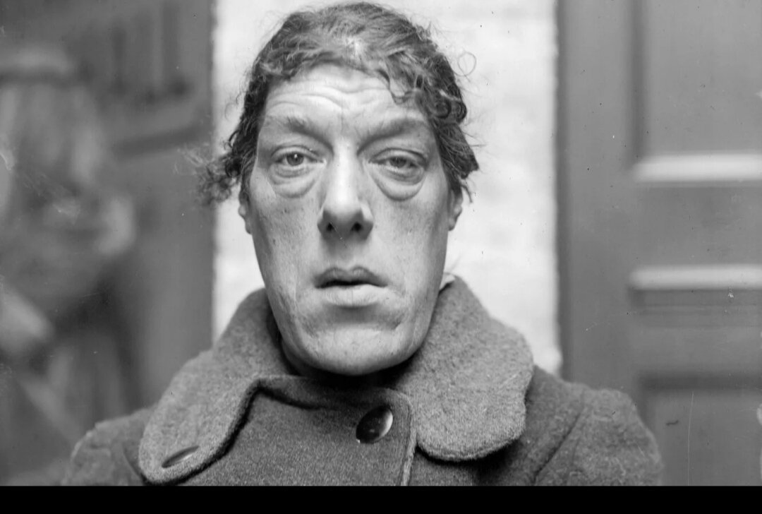 Мэри Энн Бэван "Самая уродливая женщина ХХ века