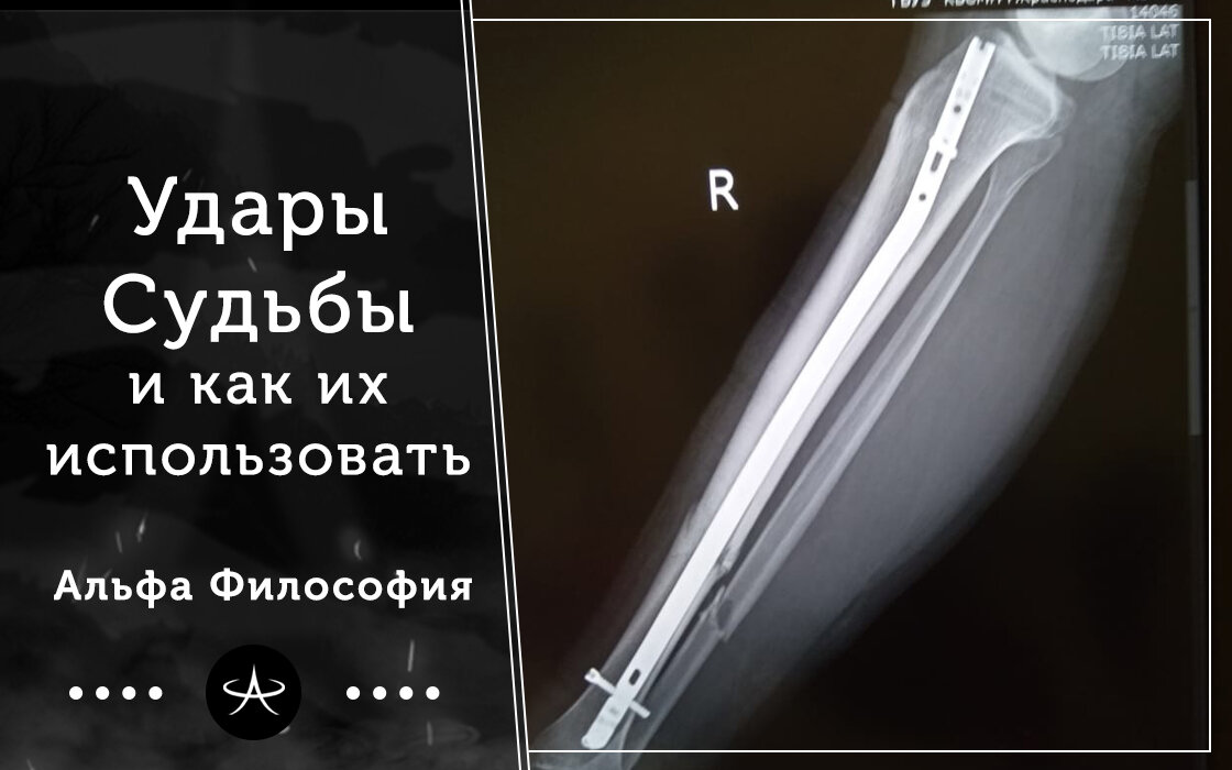 Подарки и удары судьбы 26. Удары судьбы. удары судьбы статус. как принимать удары судьбы.