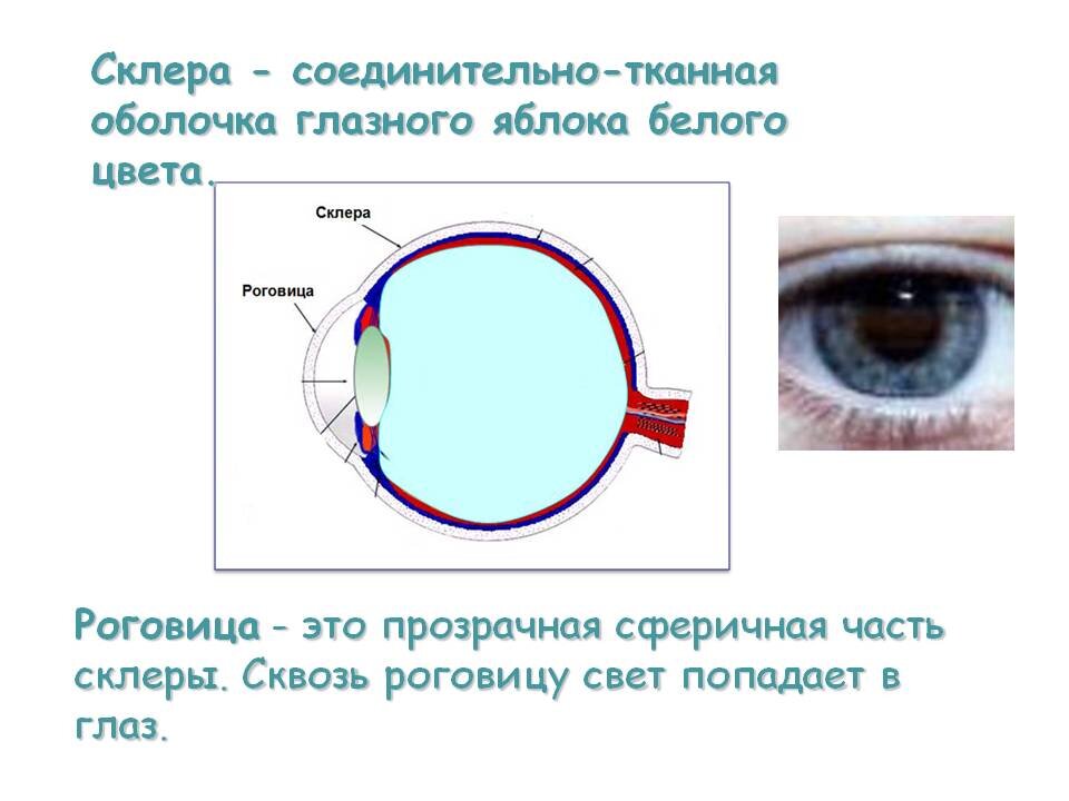 Рисунок на глазном яблоке