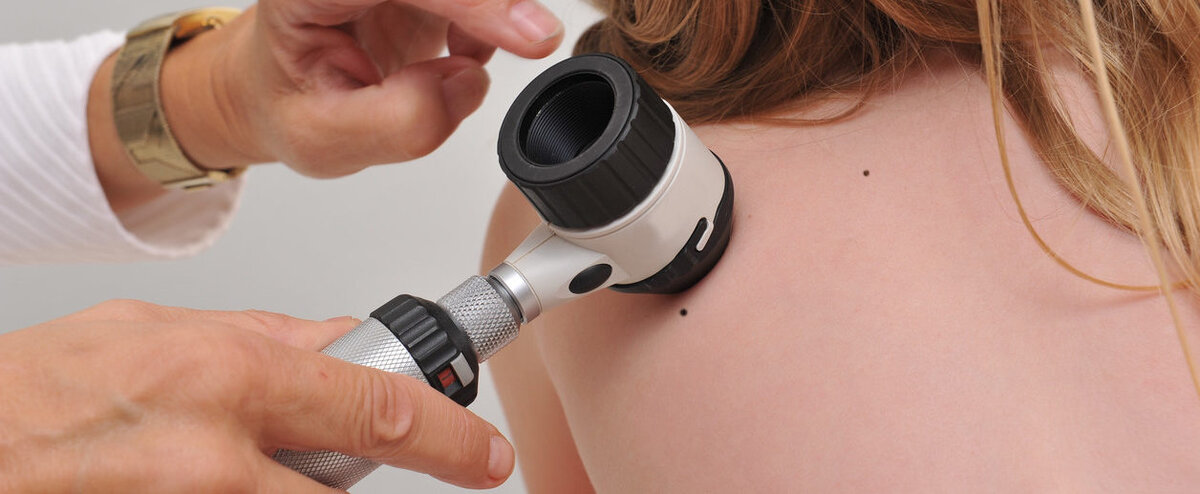 Дерматолог указала на связь между изменениями на коже и опасными болезнями