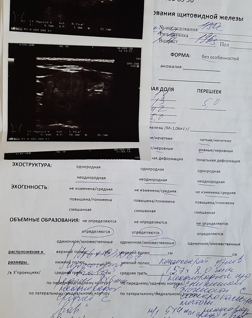 Данные моего УЗИ. В столичной больнице заставили переделать еще раз. Если поступлю по рекомендации врача, то получу такой же документ. 