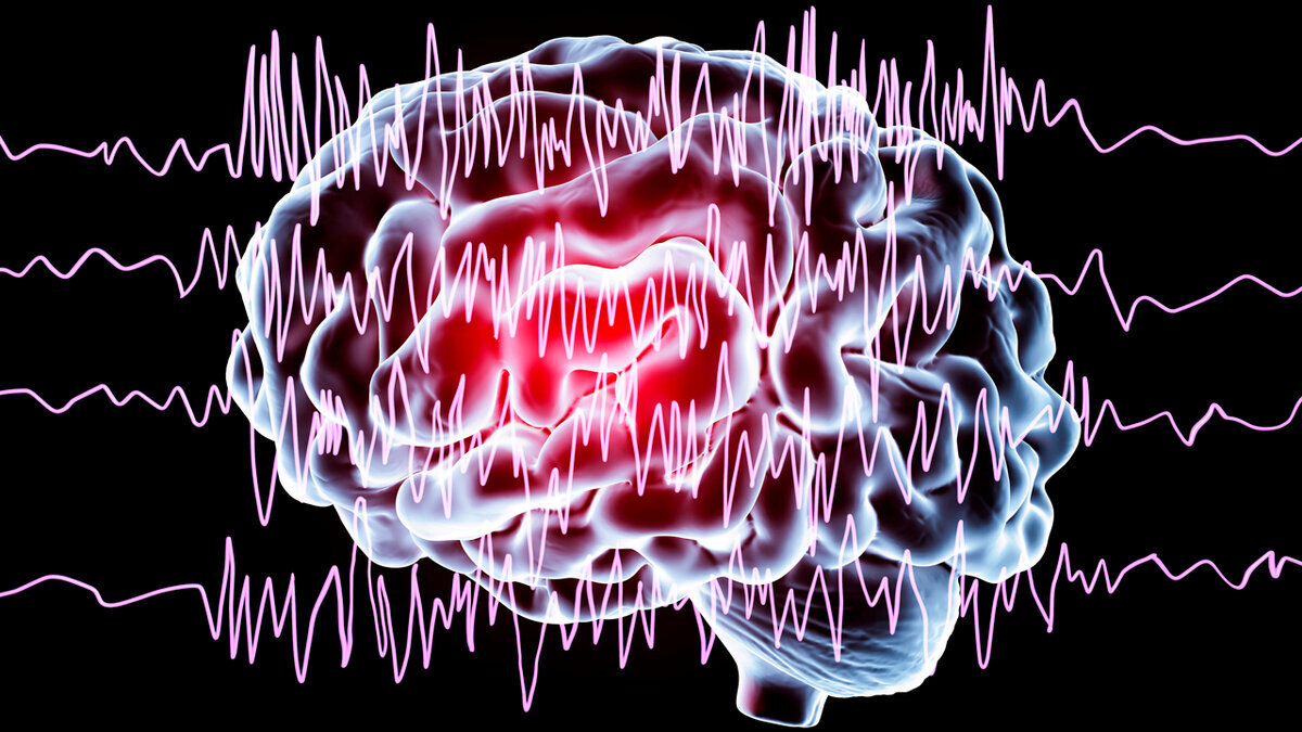 Эпилепсия. Причины и лечение — Новосибирская областная больница