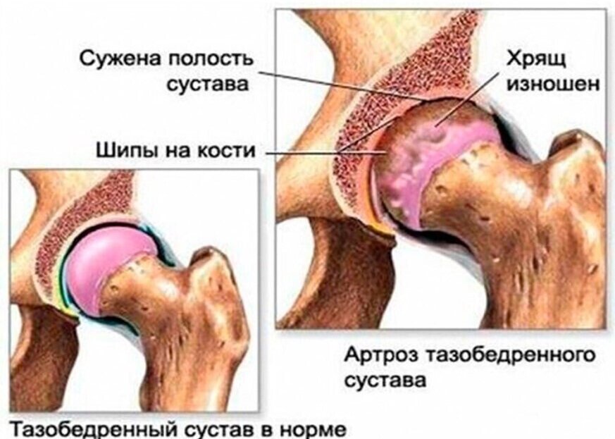 Электрофорез для грудничков