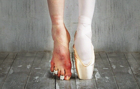 Walk a mile in my shoes... 