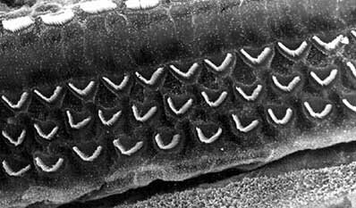 Фото: noisyplanet.nidcd.nih.gov