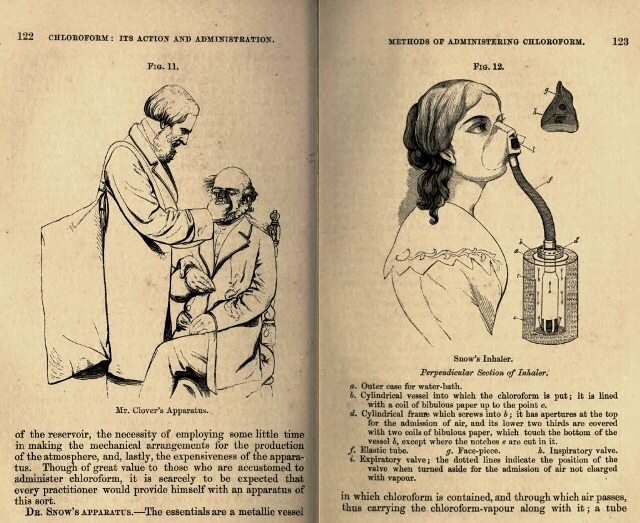 Хлороформ спящему. Хлороформ. Хлороформ для наркоза. Хлороформ наркоз 19 век. Усыпляющее средство хлороформ.