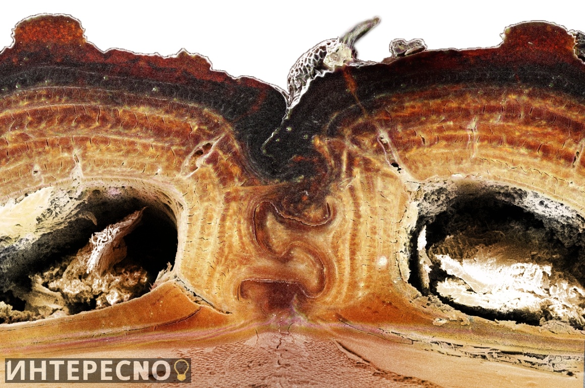 Поперечный разрез грудной клетки жука