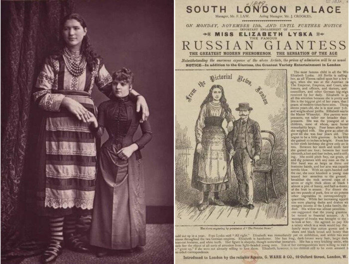 Когда Елизавете Лыско исполнилось одиннадцать лет, ее рост уже достиг двух метров.