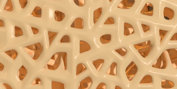 Остеопороз