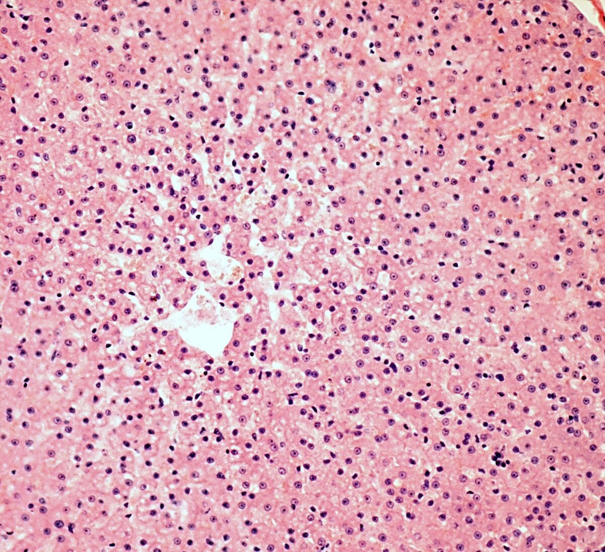 Нормальная микроструктура печени.