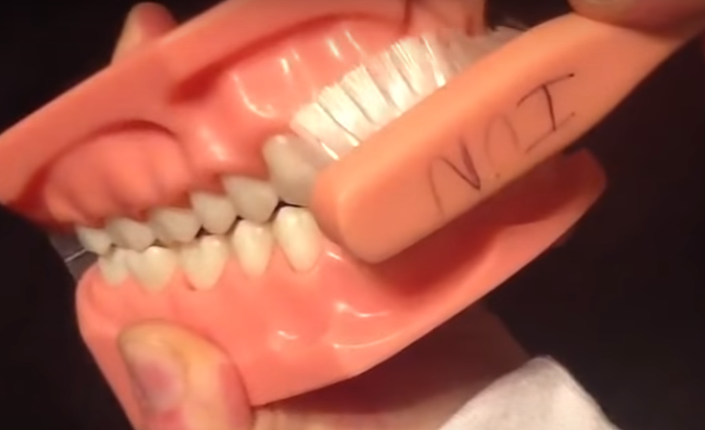 Метод Stillman: Круговые движения