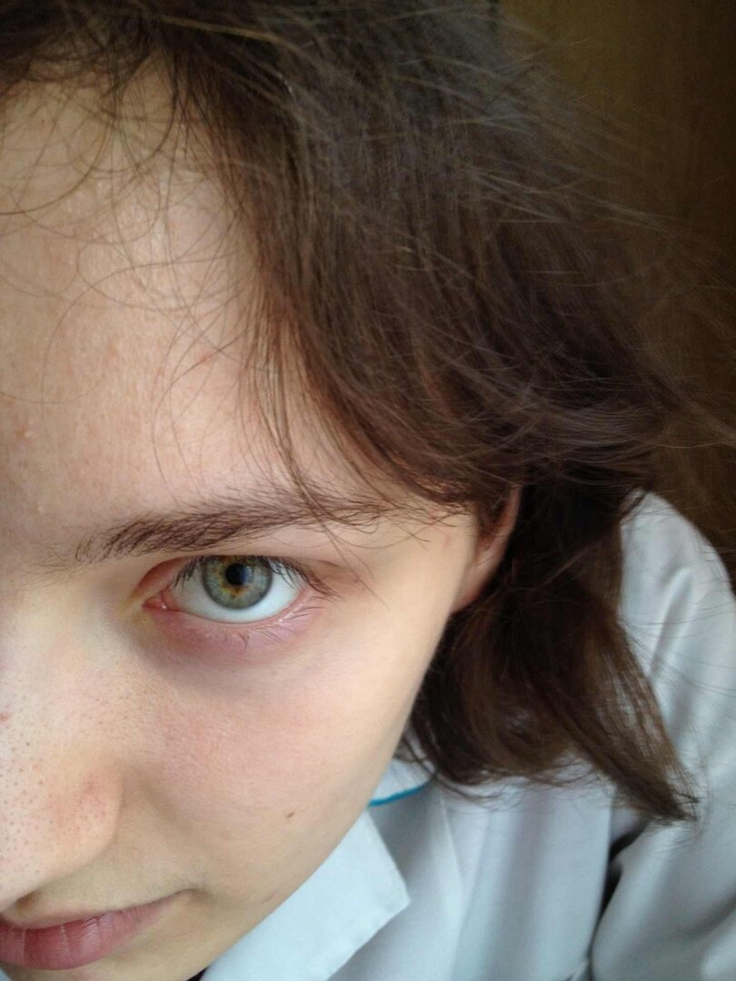 Это я на первой работе - в ПНД. Взгляд говорит о правоте старшей медсестры.