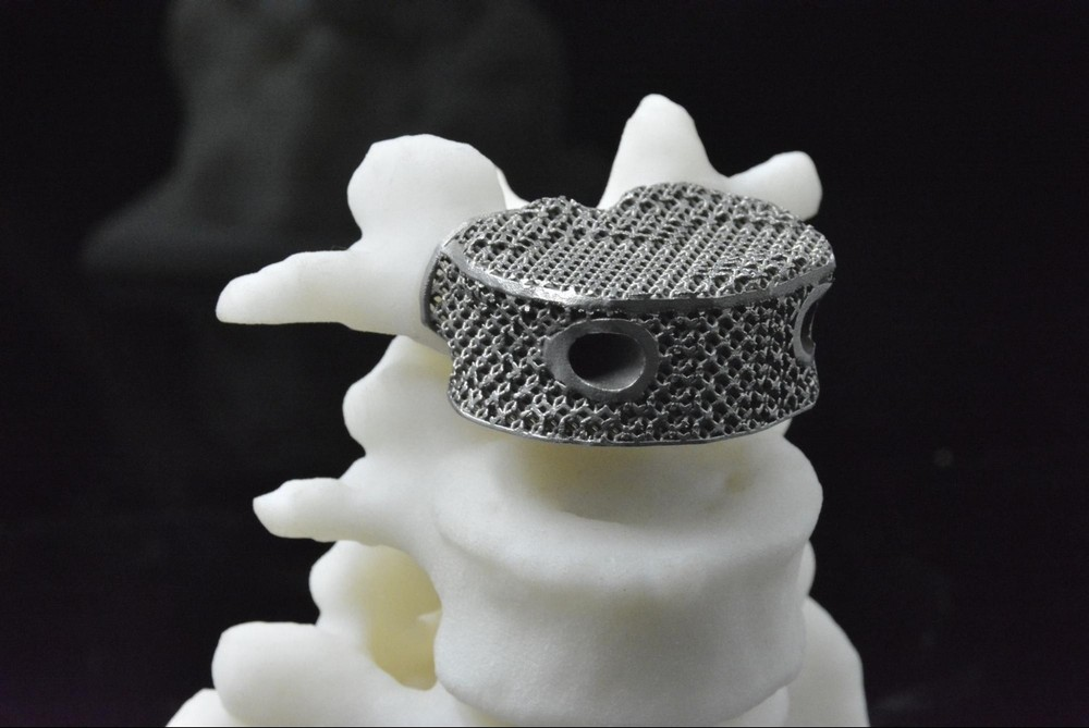 Позвоночный имплант из титана