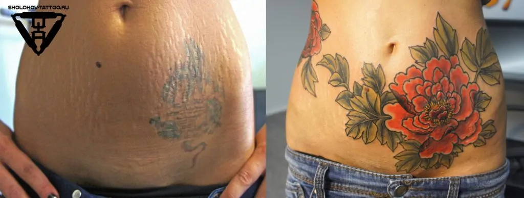 «Если сделать татуировку на худые руки, а потом накачаться, что будет с татуировкой?» — Яндекс Кью