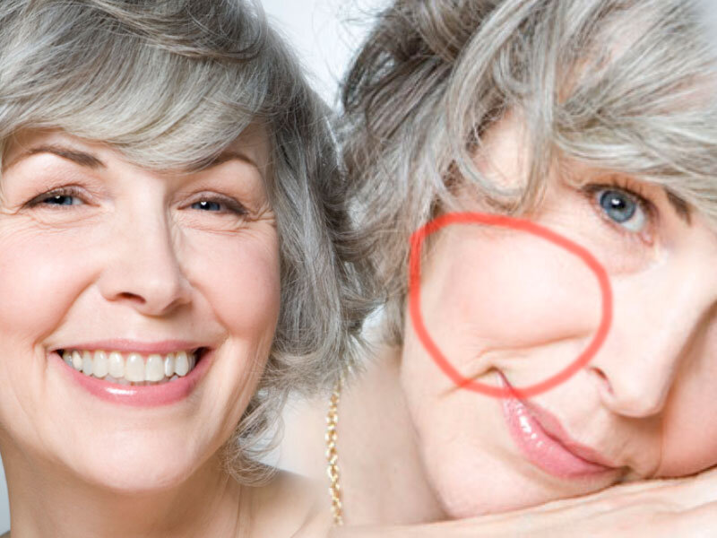 Улыбка щечки тоже поднимает, грустный же вид их опускает и появляется то самое коварное провисание кожи и заломы в области носогубных складок // фото marieclaire.ru, sunmag.me