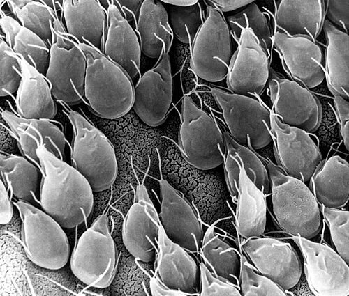 Поверхность тонкой кишки, усеянная ЛЯМБЛИЯМИ. Фото с сайта https://en.wikipedia.org/wiki/Giardia