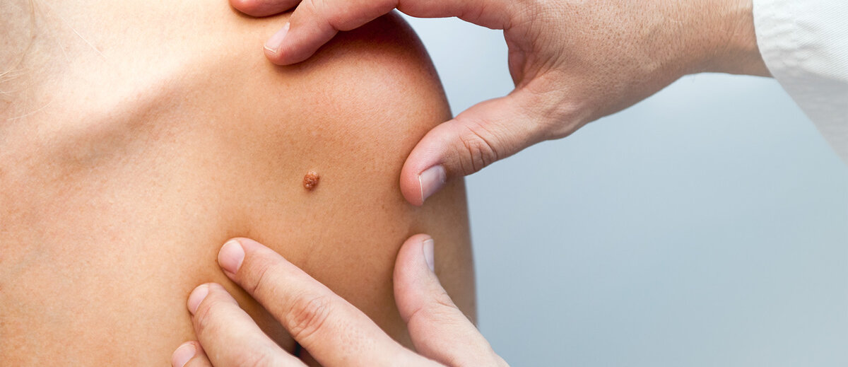 Фото: Altamedica