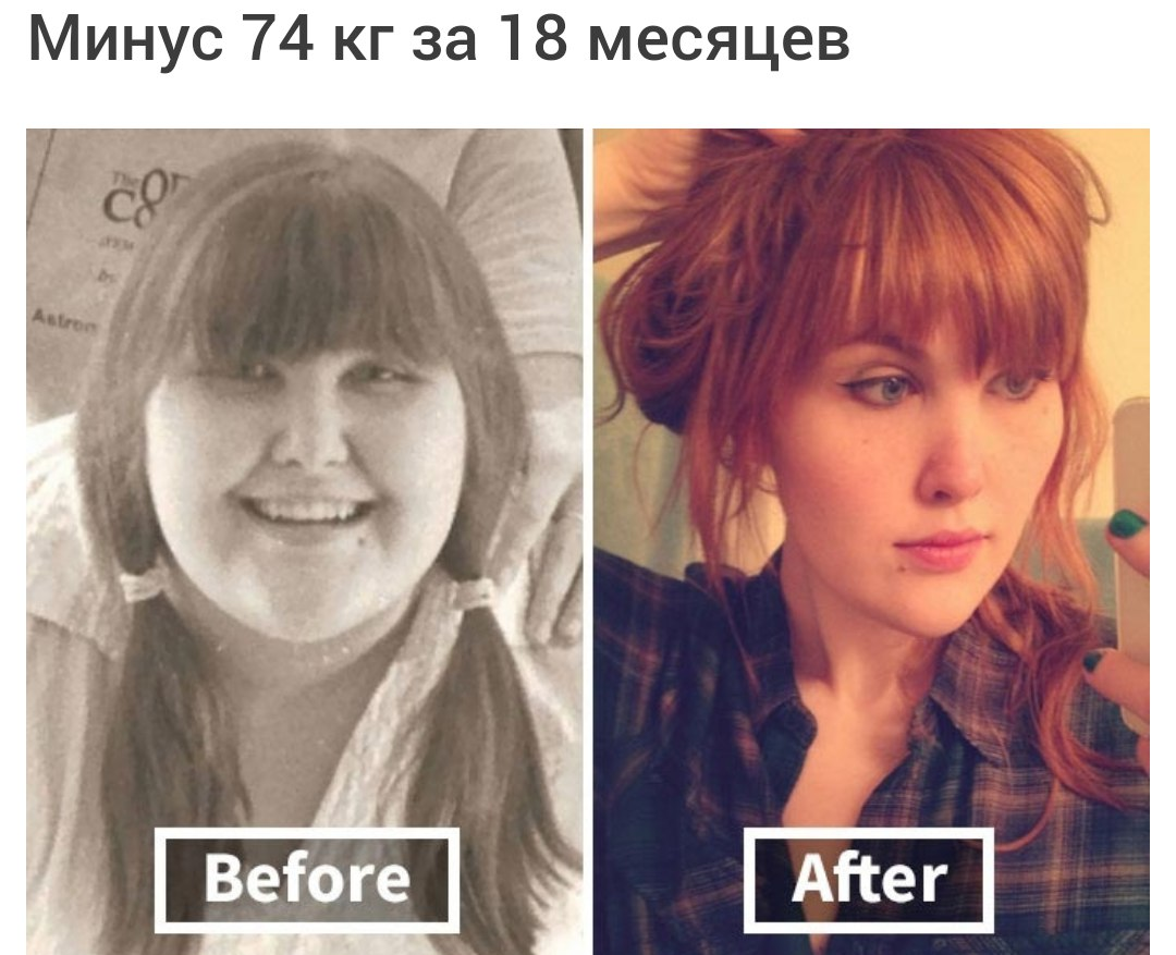 Скинуть 70. Лицо до и после похудения. Похудение лица до и после фото. Лицо после похудения до и после. Как меняется лицо после похудения.