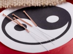 Иглы для иглоукалывания