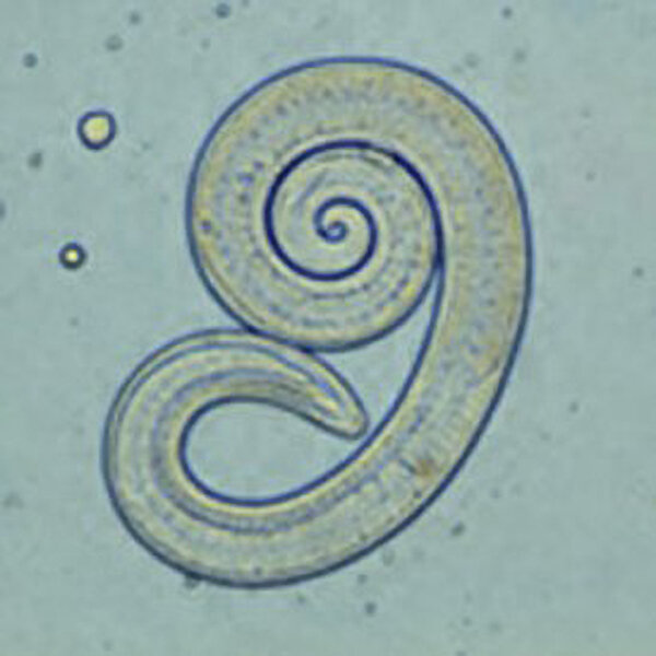 фото: Википедия. Личинка нематоды Trichinella spiralis