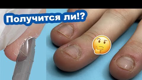 Верхние Формы для ОБКУСАННЫХ Ногтей - Получится ли!? Преображение ногтей - Маникюр и Наращивание