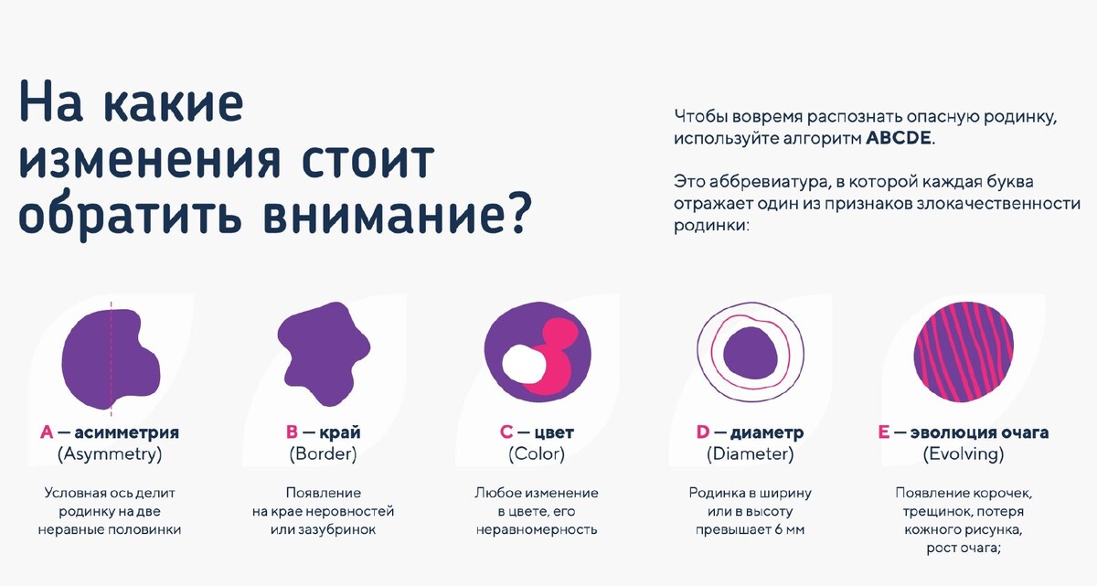 Алгоритм ABCDE