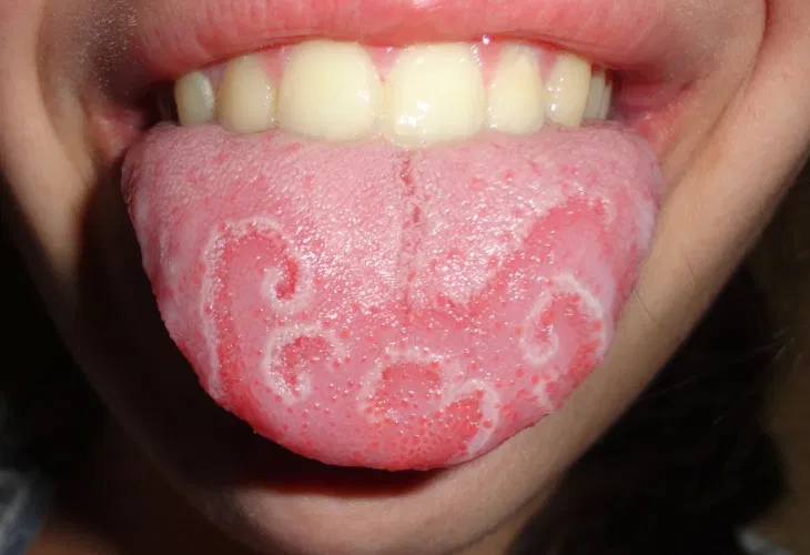 Источник фото: medicalinsider.ru