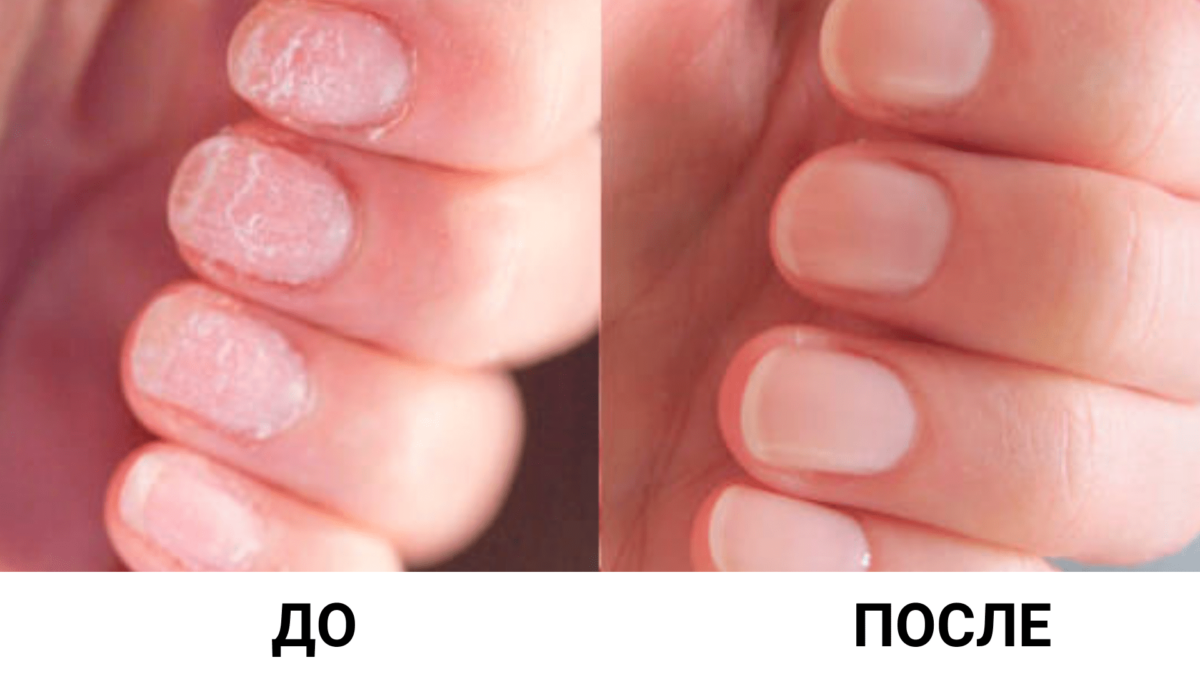 Взято с сайта https://courseburg.ru/news/kak_ukrepit_nogti_v_domashnih_usloviah-p10064.html/amp