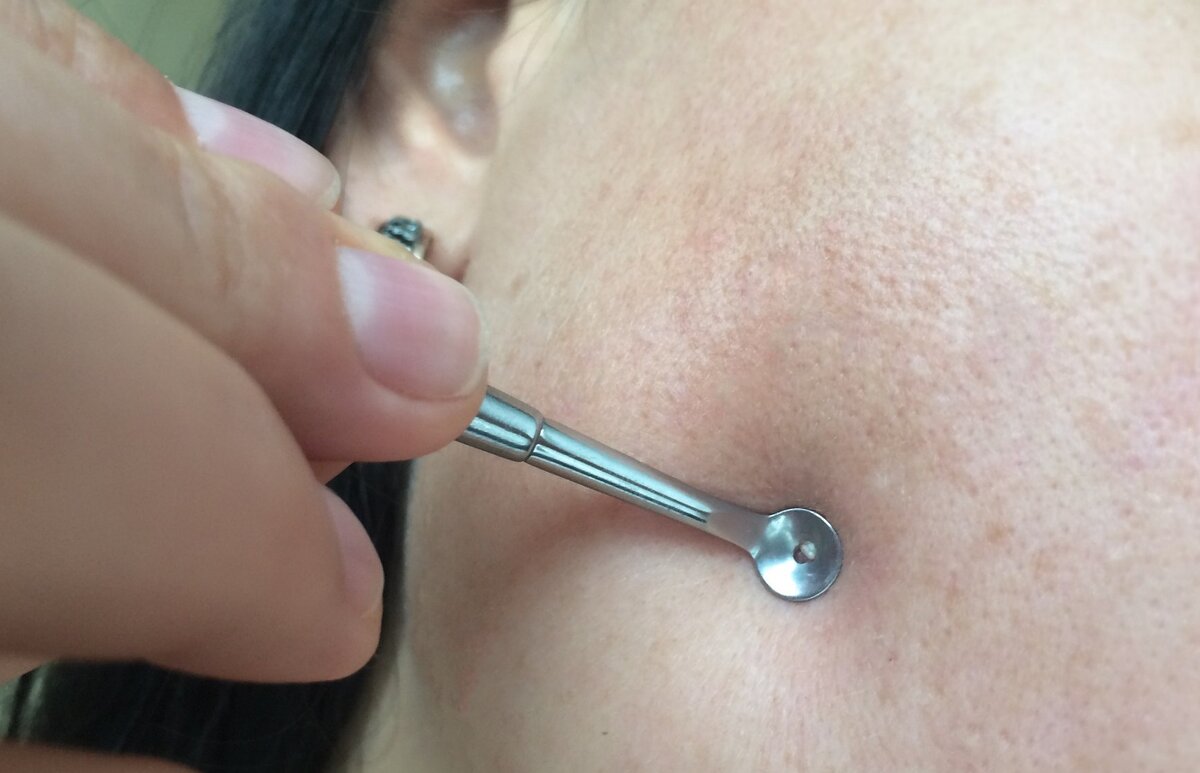 На фото работа с помощью ложечки Уно.