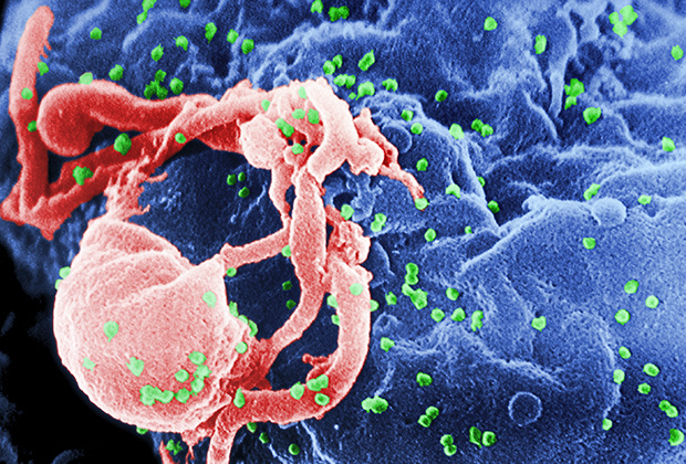 Зараженный ВИЧ Т-лимфоцитФото: C. Goldsmith / Centers for Disease Control and Prevention
